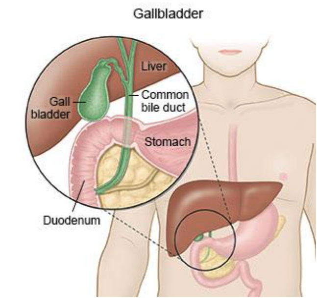 Gallbladder Disease