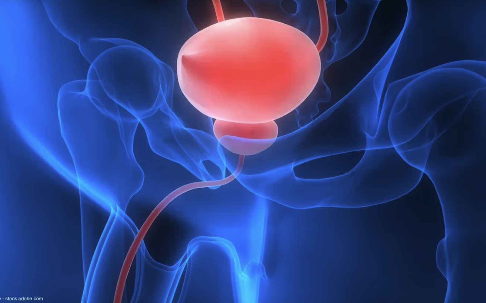 blue light bladder