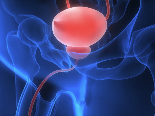 blue light bladder